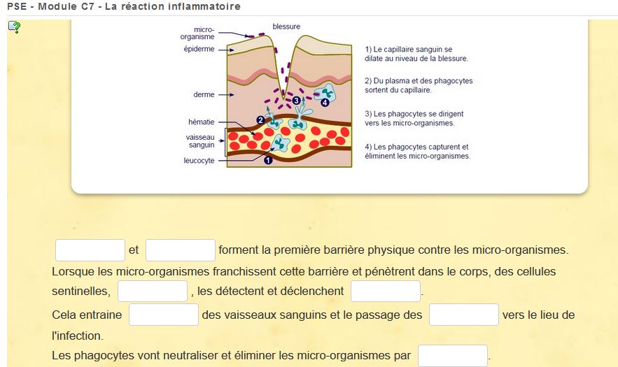 Texte à trous